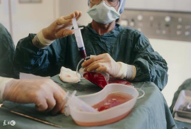骨髓移植手术过程(骨髓移植手术怎么进行)